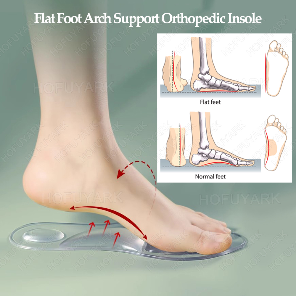 Sol Gel Silikon Sol Plantar Fa - Women'S Shoes High Arch Support ulasan dan harga
